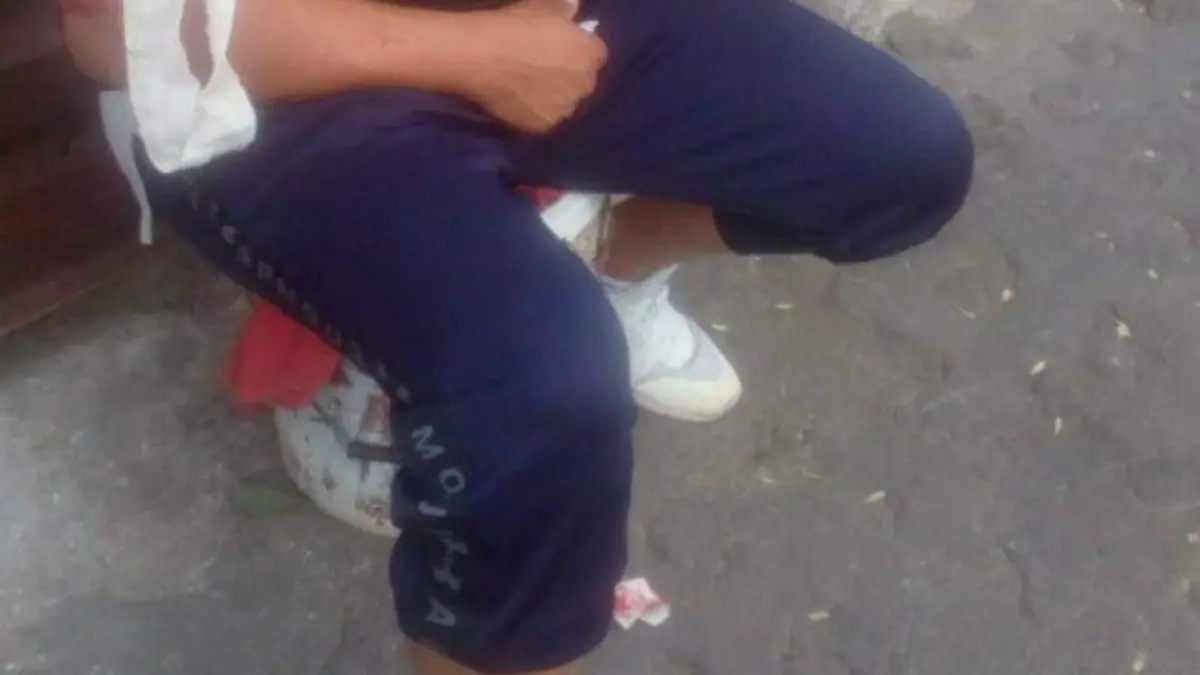 Ataque Ocotepec (2)