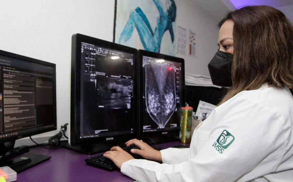 estudios-cancer-de-mama-imss