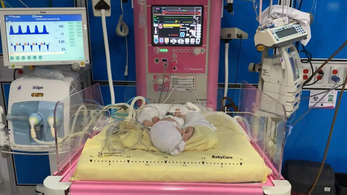 Trillizas en Yautepec (2)