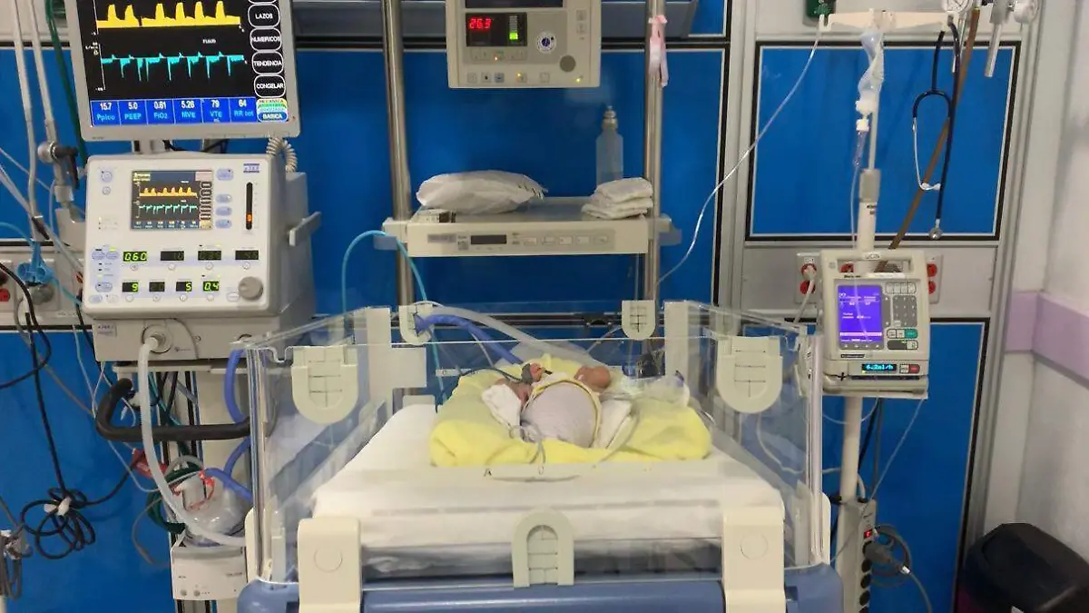 Trillizas en Yautepec (1)