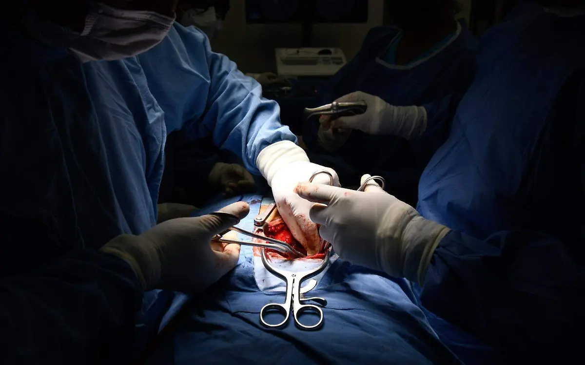 transplante-de-organos