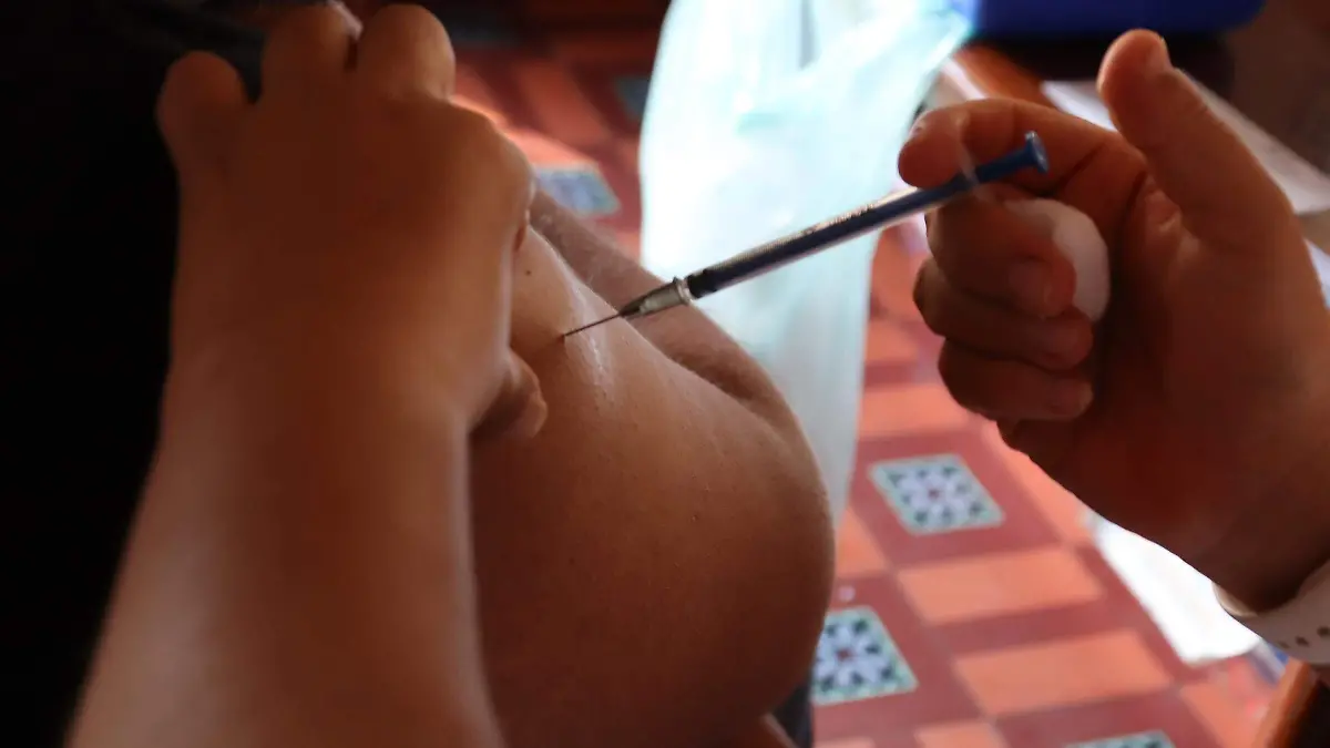 saludosis-sarampion2-luis-flores