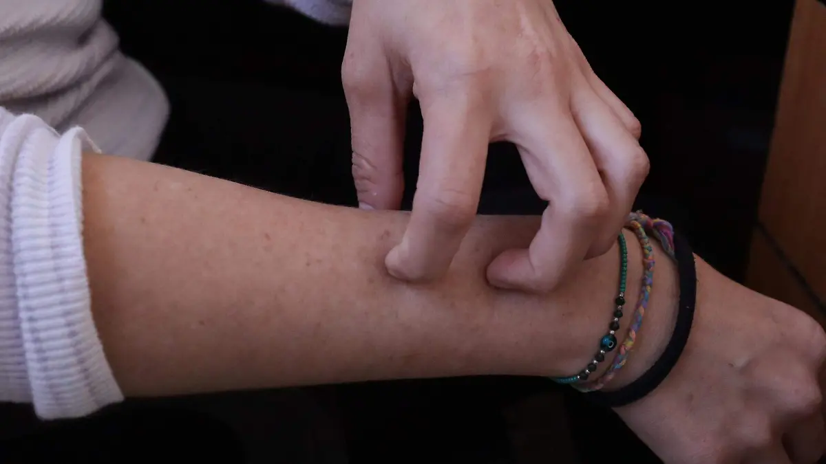 vacunasarampion-sectorsalud2-luis-flores