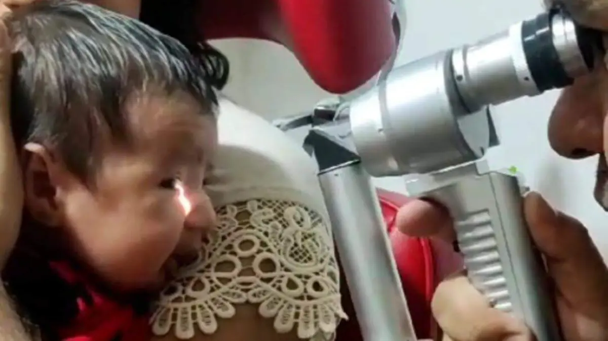 Niños podrían sufrir ceguera sin el “Tamiz visual Neonatal”