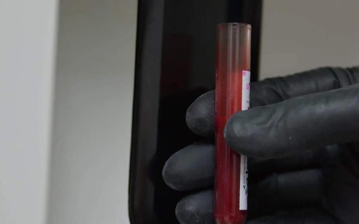 Ayuntamiento de Gómez Palacio continúa apoyando con pruebas de antígeno prostático