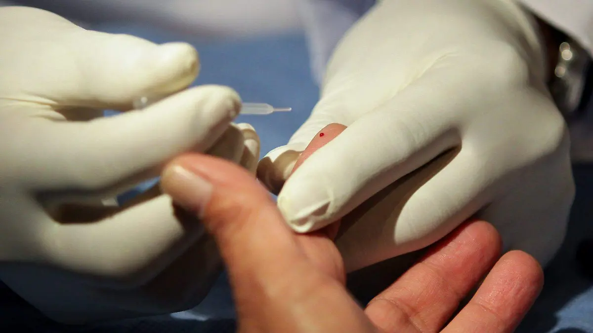 Muestra de hepatitis