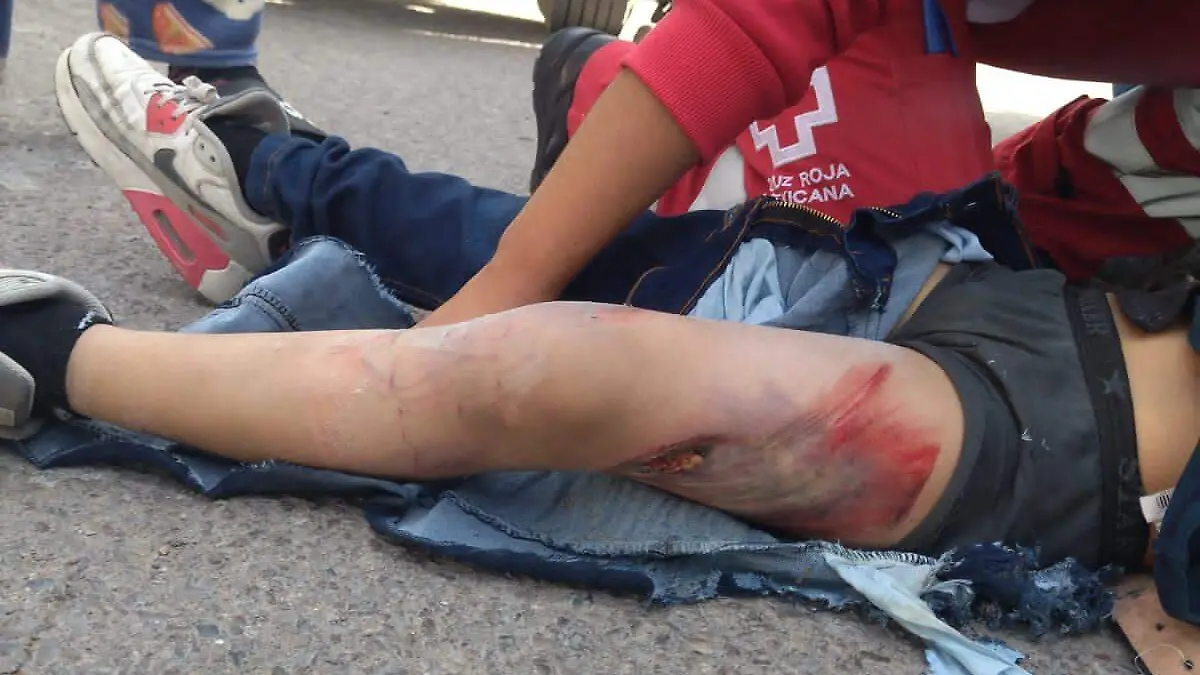 Niño es atropellado en el Centro de Gómez Palacio