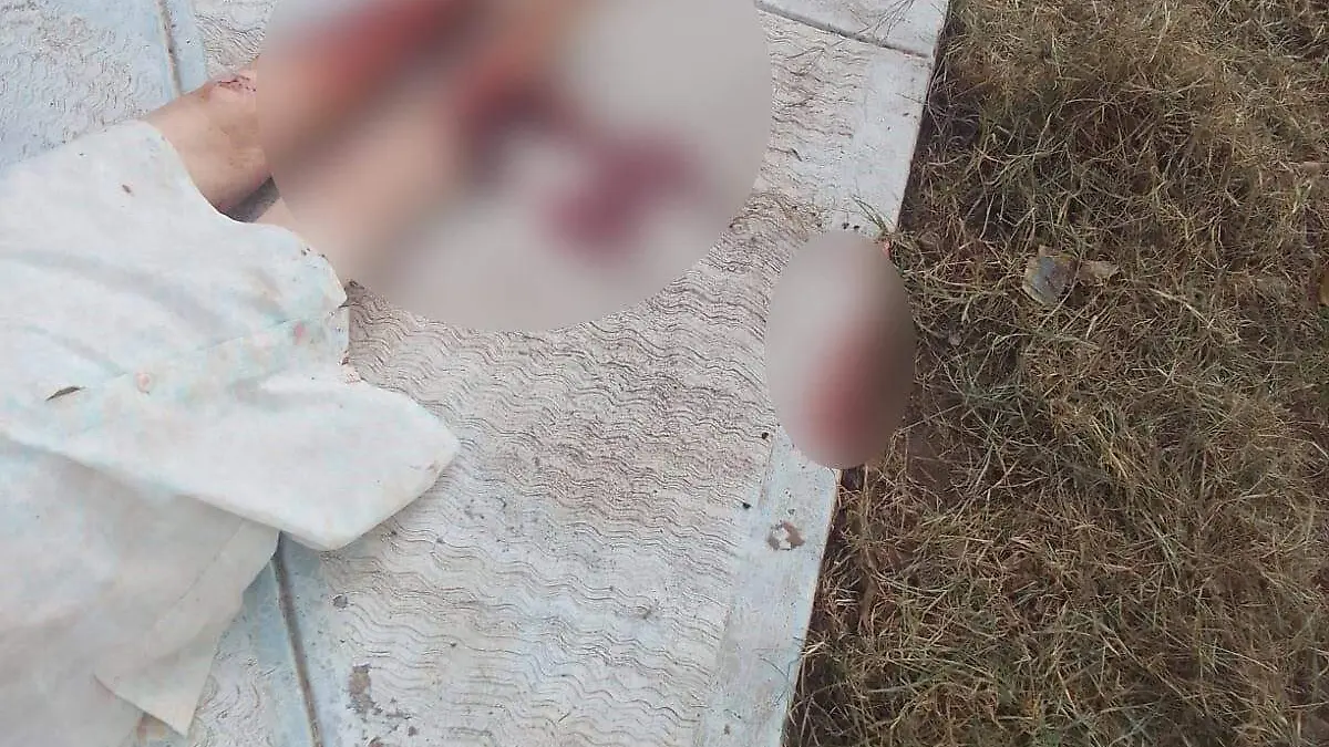 Grave persona atacada por dos perros en poblado de Canatlán