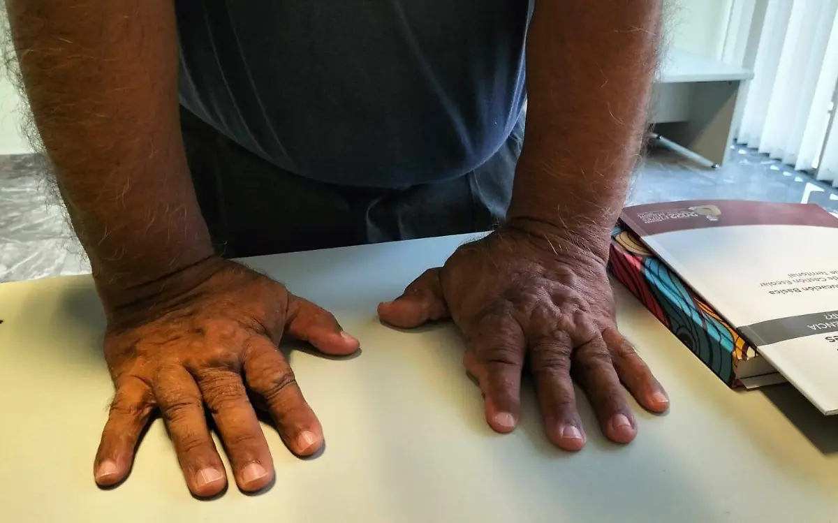 El señor Gerardo Vitela Alemán Busca apoyo para cirugía vascular periférica