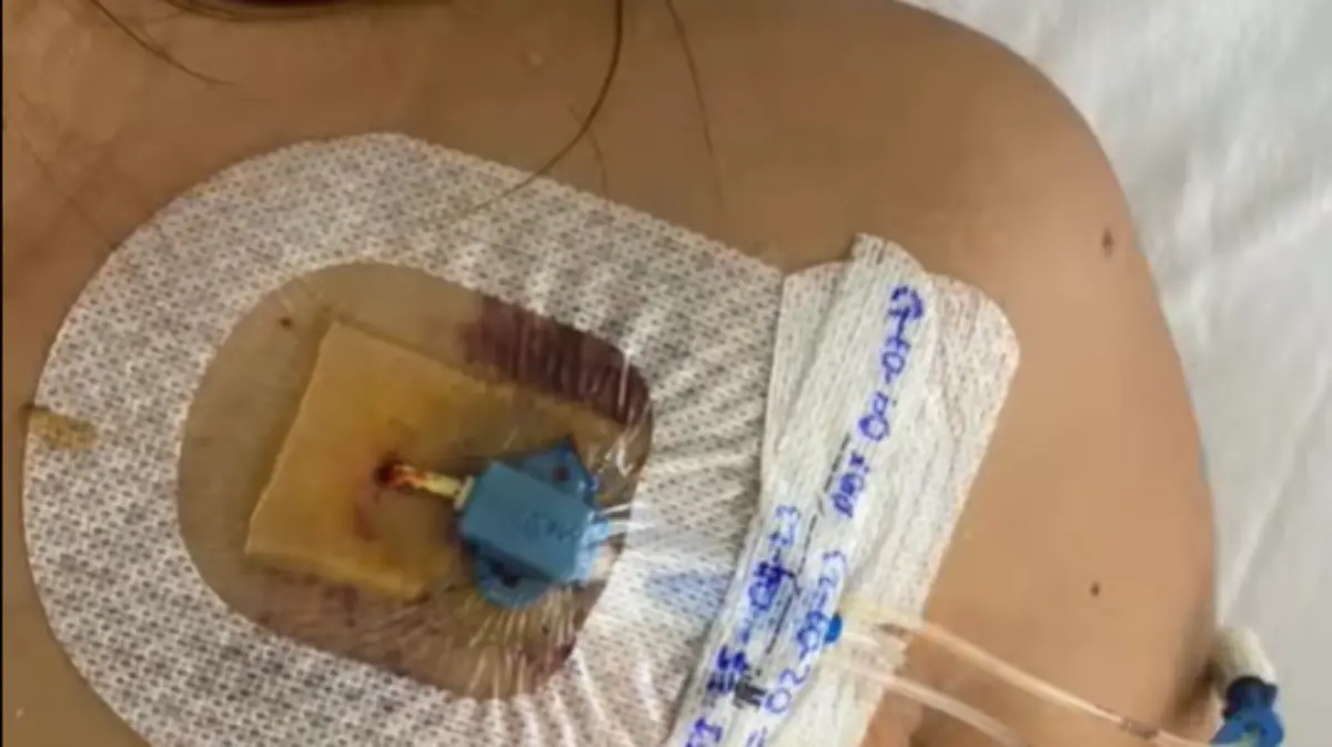 Duranguense requiere 150 mil dólares para salvar su vida