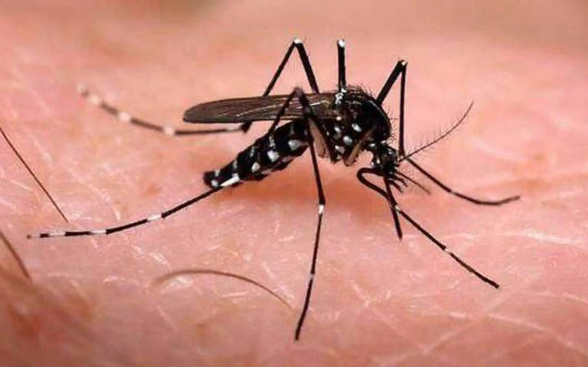 Dengue