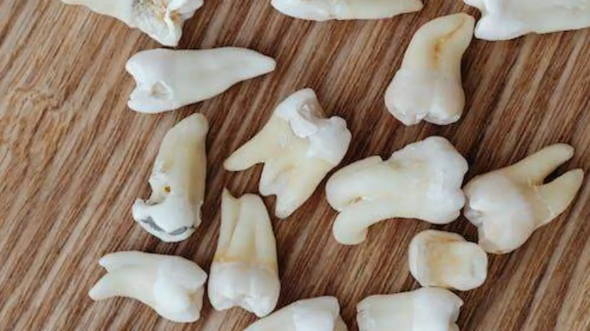 ¿Qué significa soñar que se te caen los dientes?