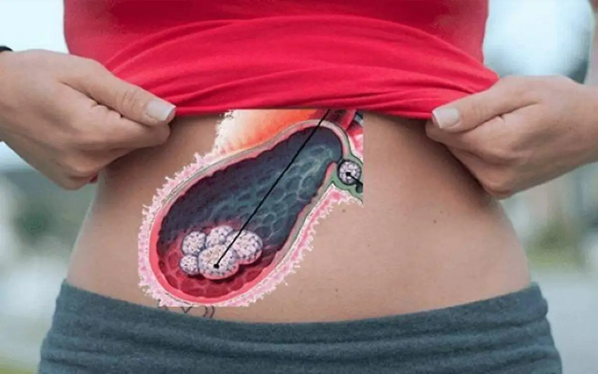 ¿Qué es la vesícula biliar y para qué sirve? Te explicamos