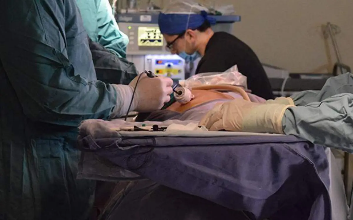 ¿Qué es la laparoscopia?