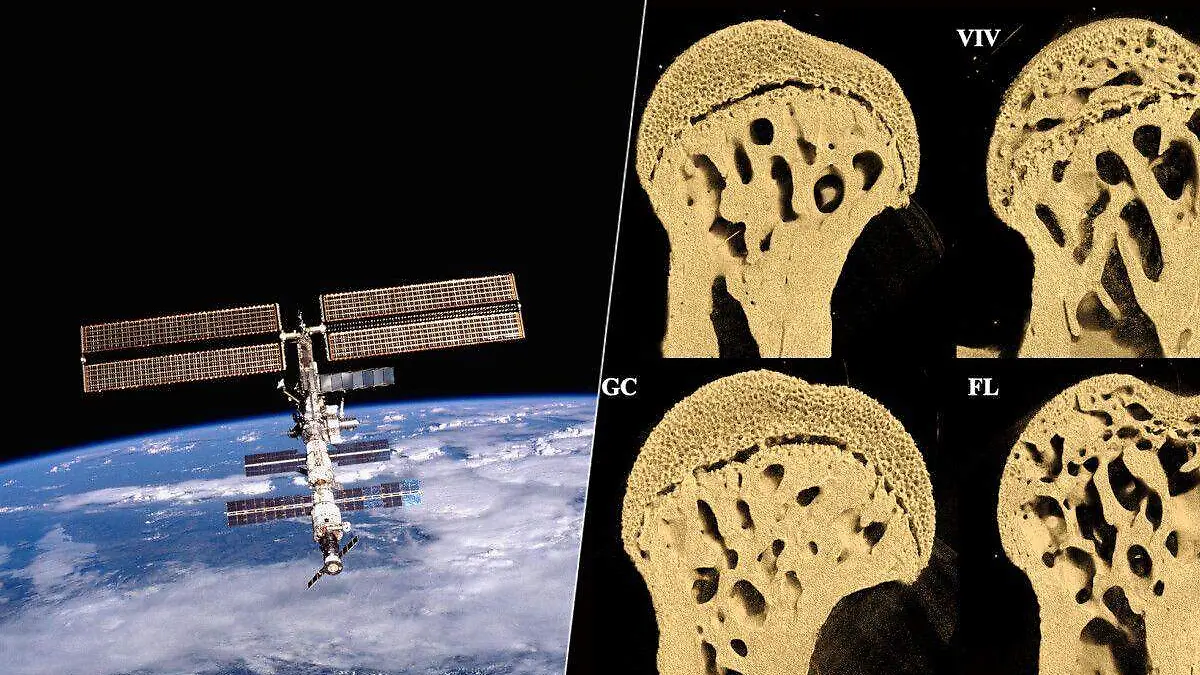 La medicina espacial