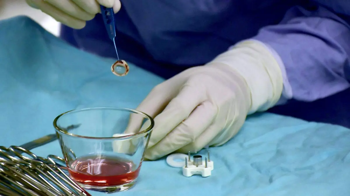 Durango suma 24 trasplantes de córnea en 2026