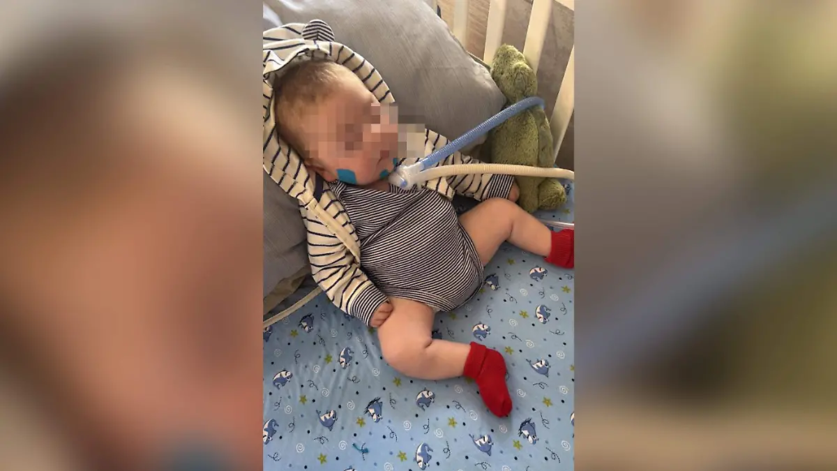 Marcelo, bebé duranguense con síndrome poco común: abren campaña de donaciones 