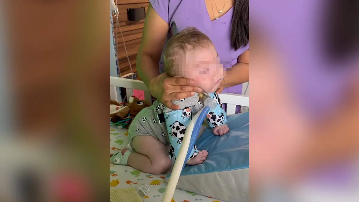 Marcelo, bebé duranguense con síndrome poco común: abren campaña de donaciones 