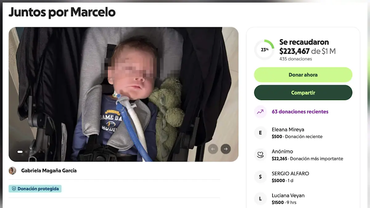 Marcelo, bebé duranguense con síndrome poco común: abren campaña de donaciones 
