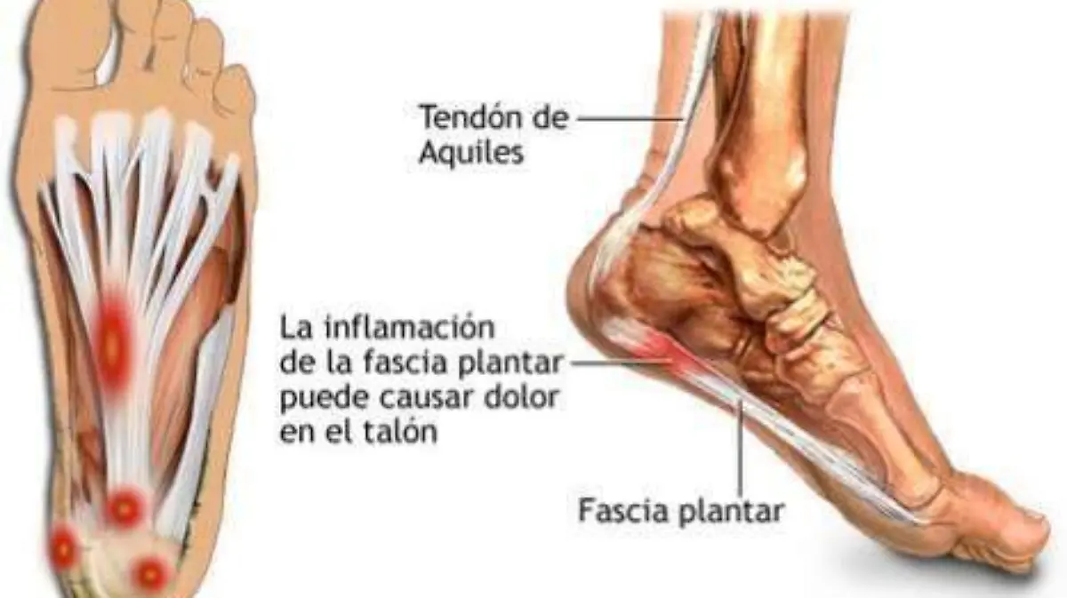 La planta del pie cuenta con aproximadamente 360 glándulas sudoríparas