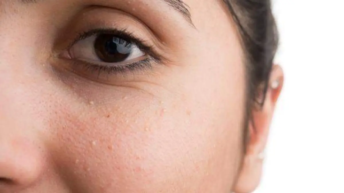 ojos