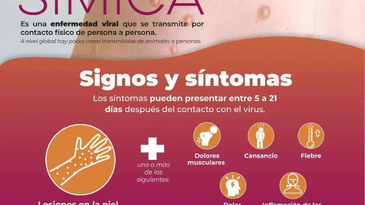 Confirman en Sonora dos casos de viruela del mono