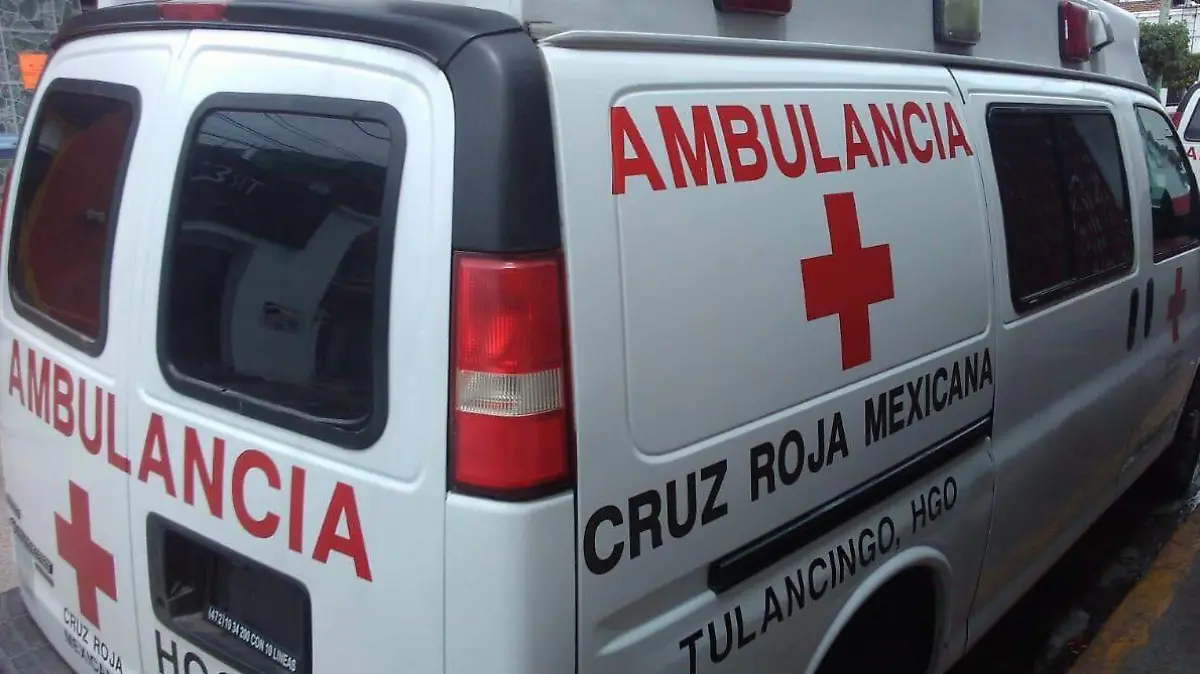 MENOR SE QUEMÓ CON AGUA