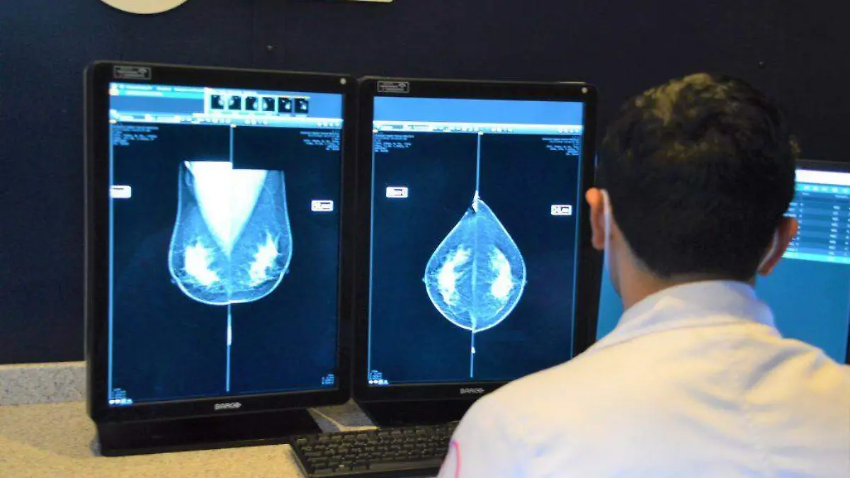 PROYECTA IMSS REALIZAR 63 MIL MASTOGRAFIAS ESTE 20231 (1)