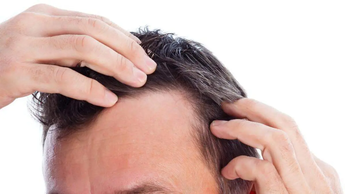 img_mrius_20190503-134401_imagenes_lv_terceros_caida_cabello-kZ6D-U462006565846hiF-992x558@LaVanguardia-Web