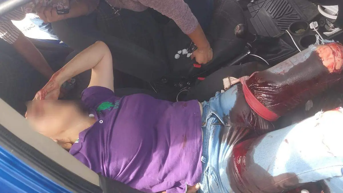 24 Balean a mujer para despojarla de su bolsa2