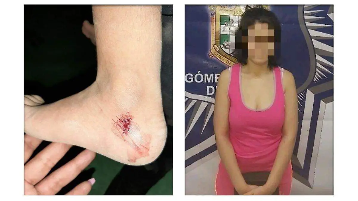 Detenida madre agresiva GP