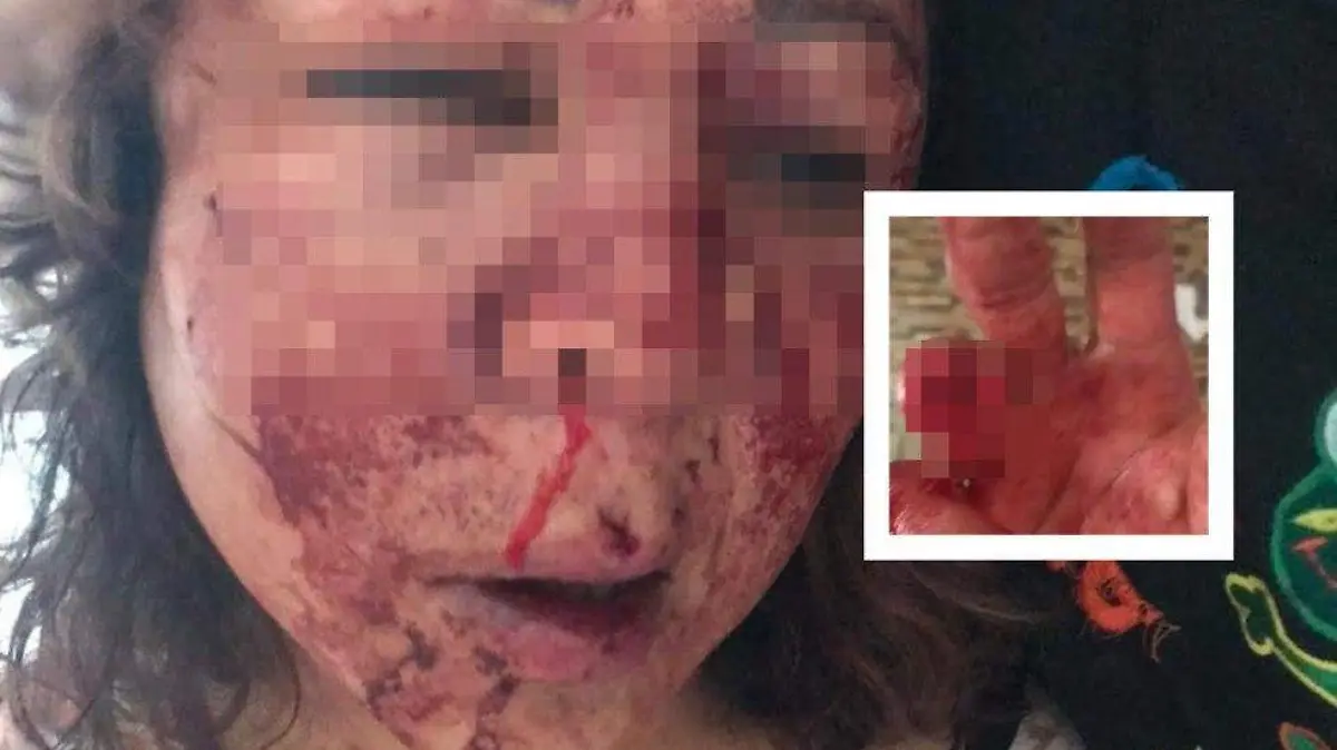 mujer golpeada