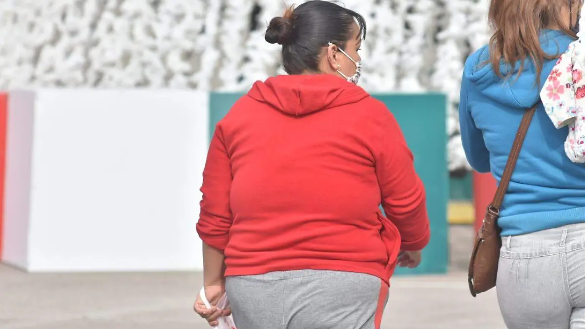 Obesidad