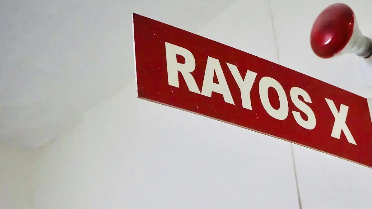 RAyos X