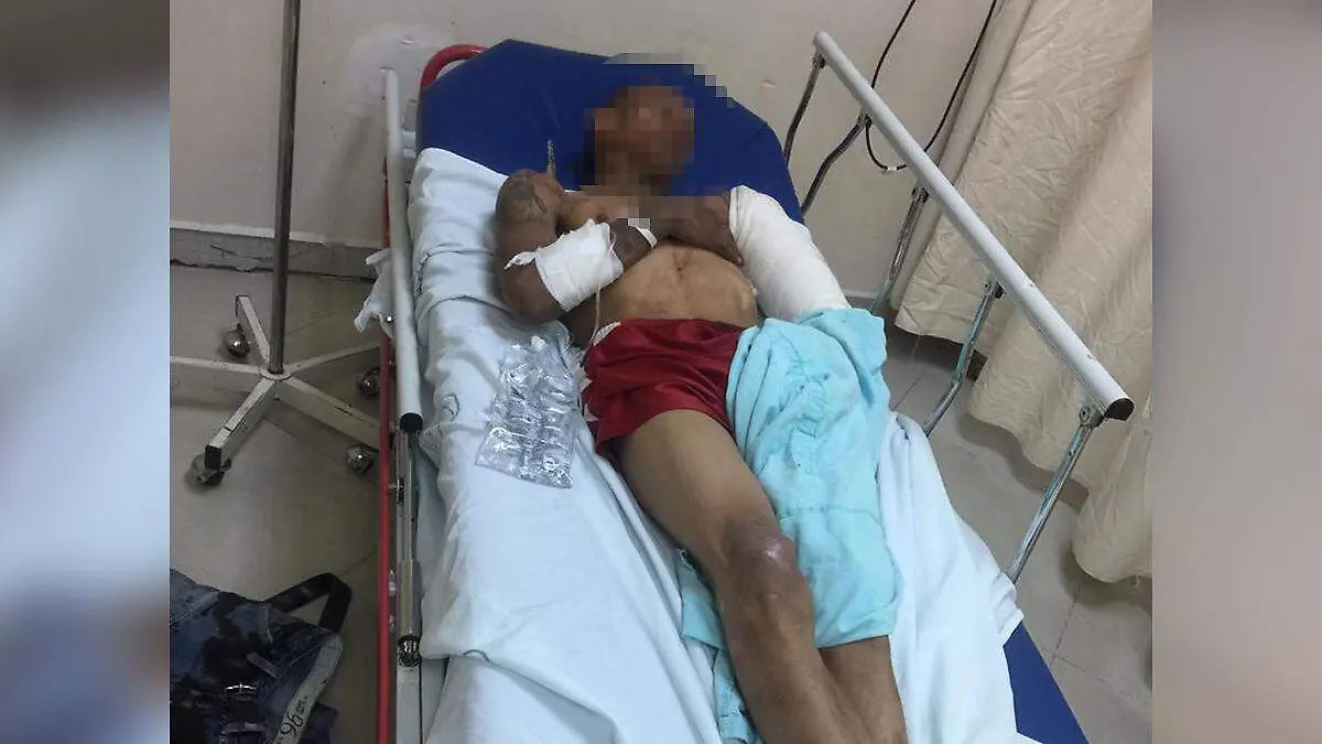 Herido de bala Torreón