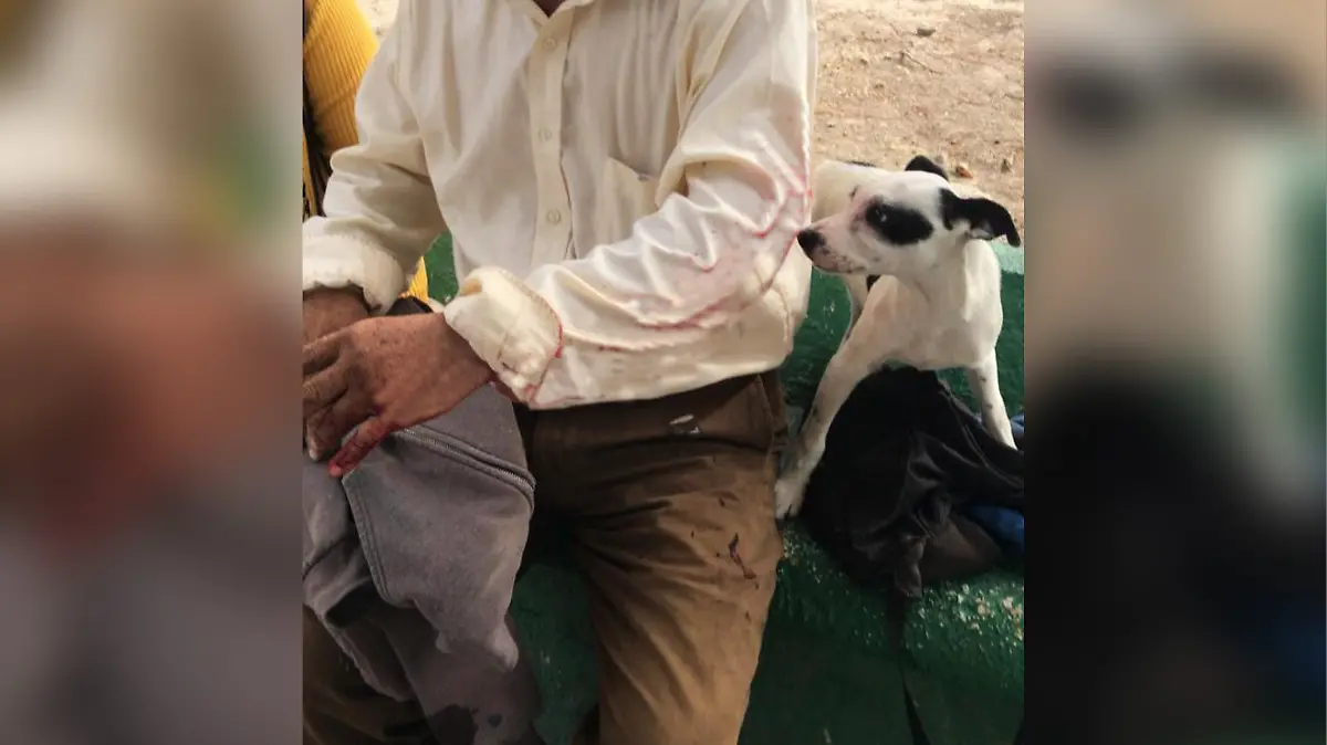 ataque-en-la-resurrección