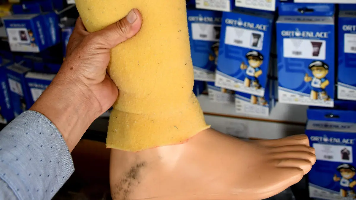 proyecto protesis (2) ok