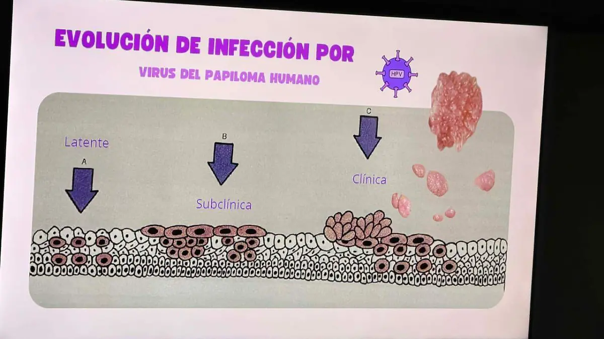De esta manera avanza progresivamente la infección