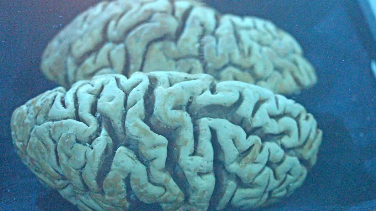 cerebro_2