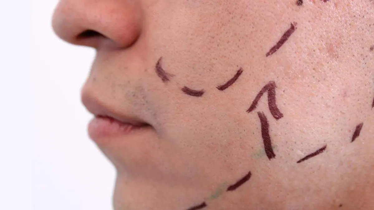 Cirugía Plástica 2