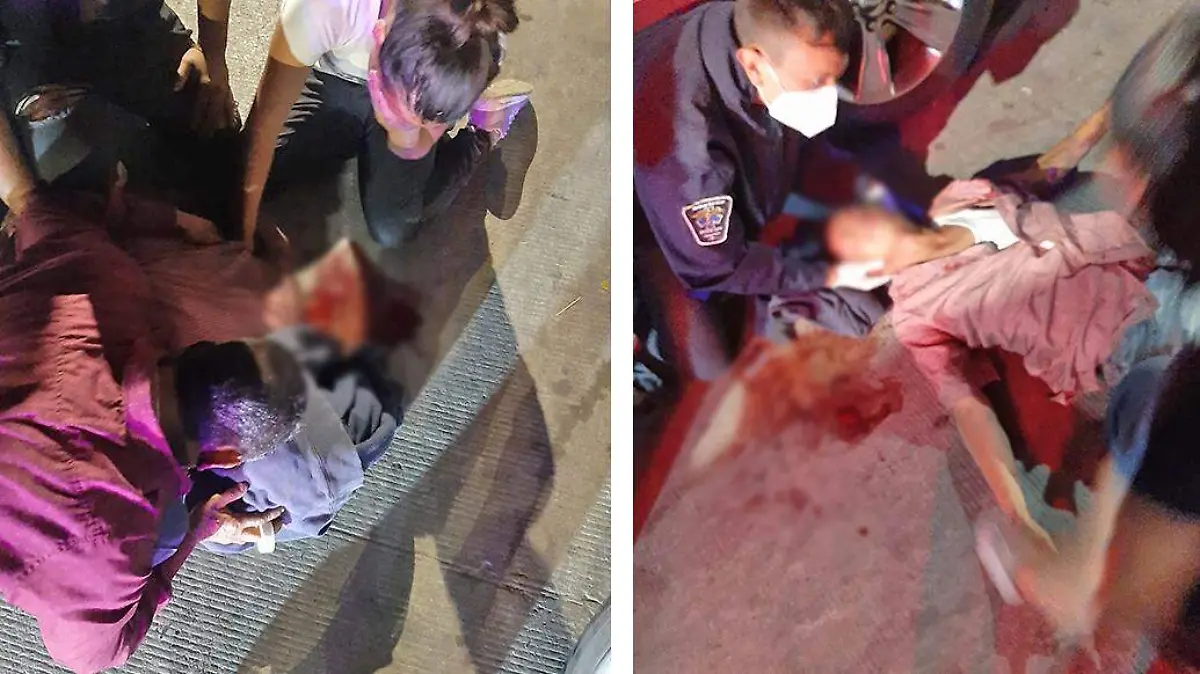 hombre atropellado