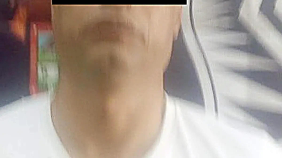 Golpeador 2