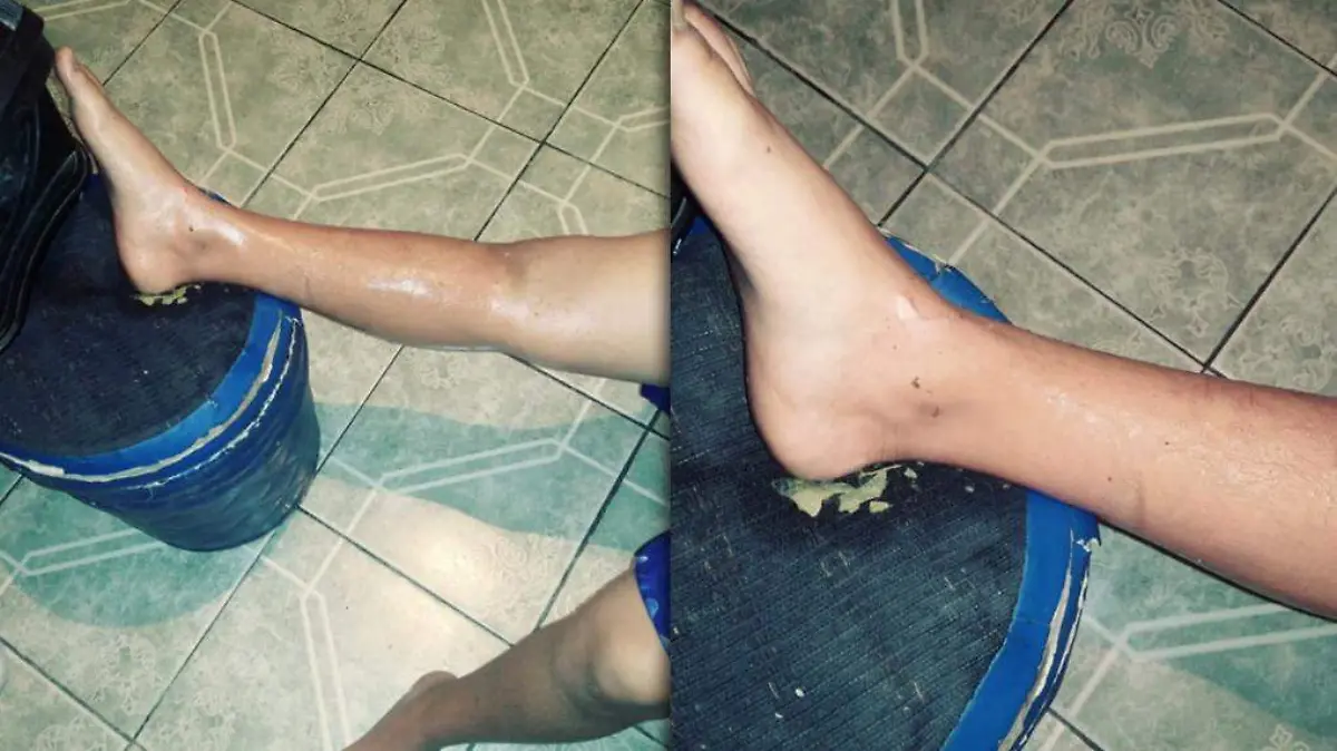 Marca de Agua Fotos-Recuperado