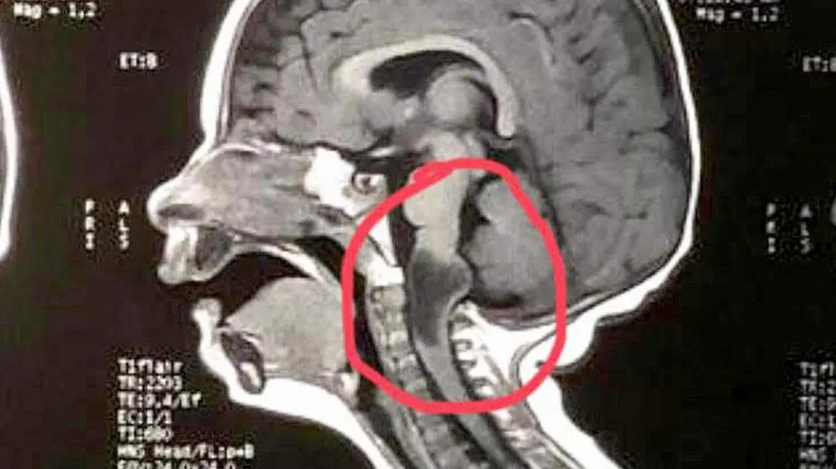Radiografía de Eleni