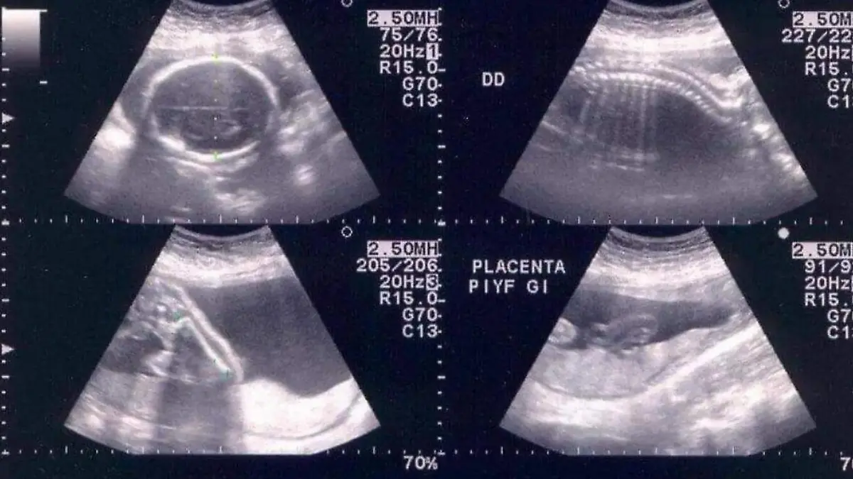 ABORTO-MUJERES-DERECHOS