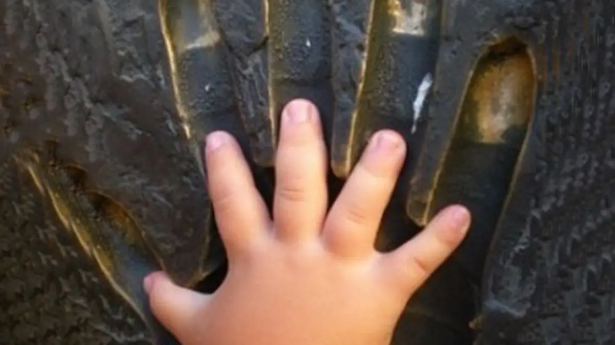 ACONDROPLASIA-CONDICIÓN-GEN