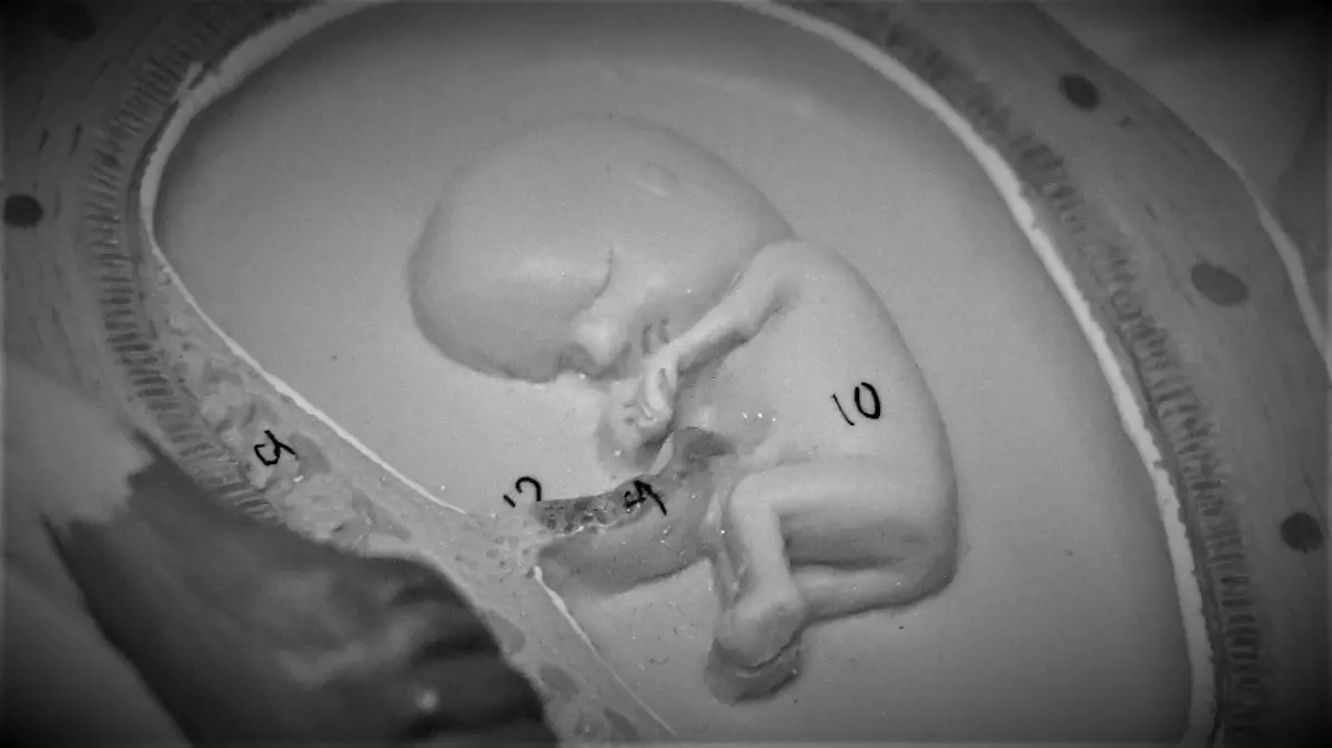 NO NACIDOS-LEY-BEBES