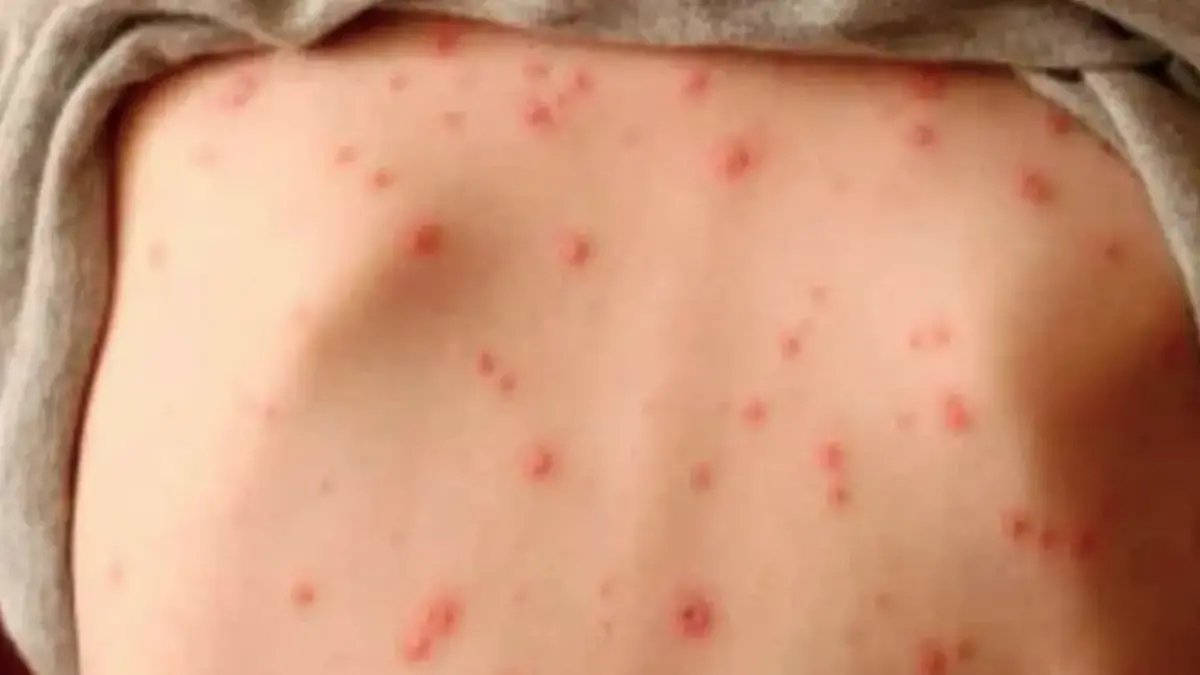 Captura de pantalla 2026-01-20 a la(s) 11.37.40