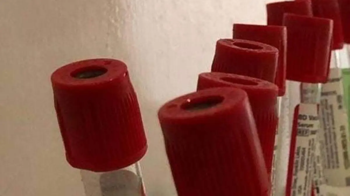 ALUSIVAS A TOMOGRAFÍA  o VIH (1)