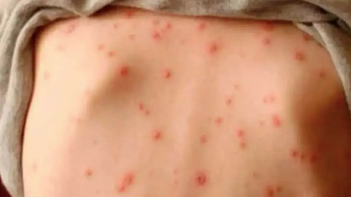 Captura de Pantalla 2026-04-17 a la(s) 10.34.23